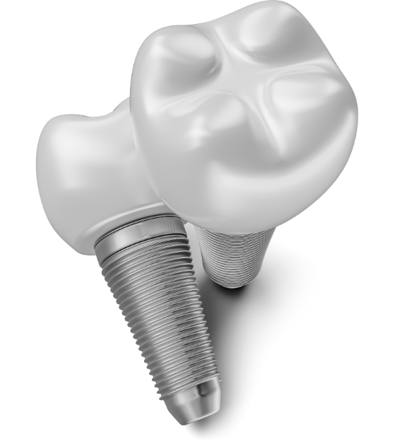 Implatológia fogbeültetés