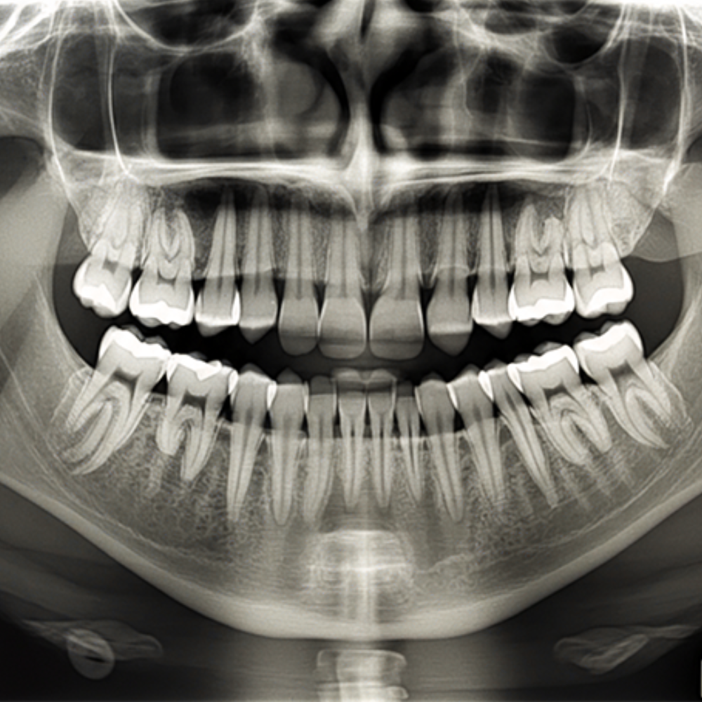Fogászati Röntgen