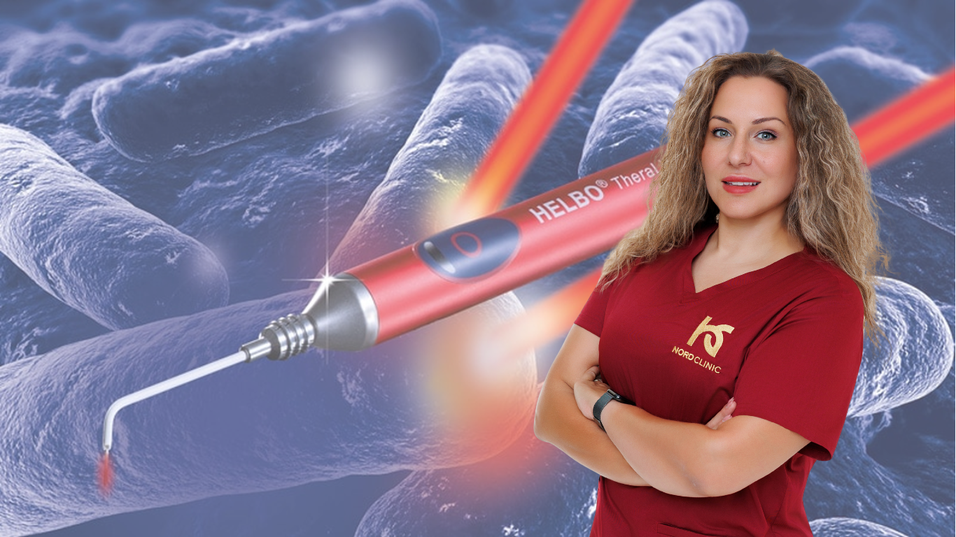 Helbo lézerterápia NordDental