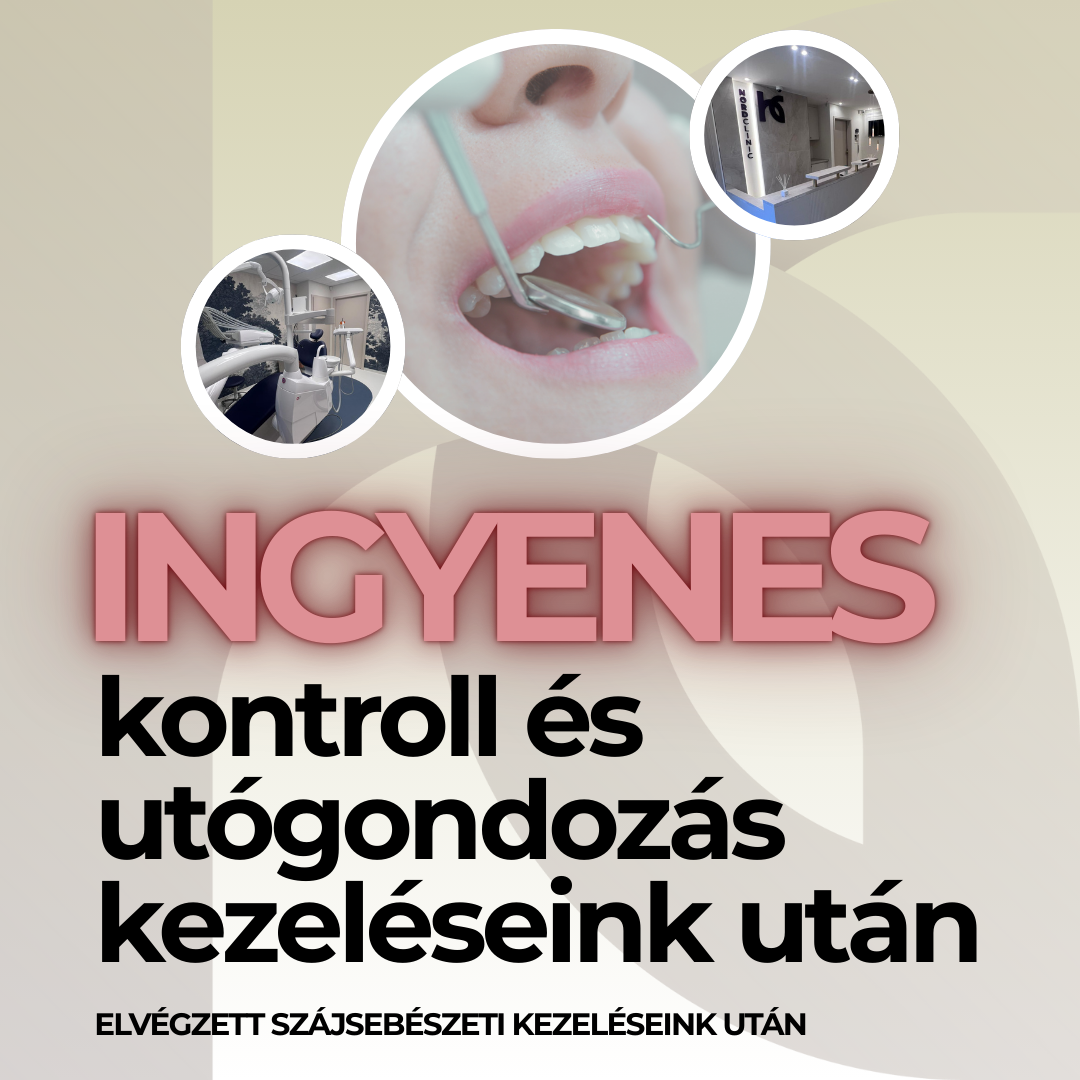 NordDental árak - ingyenes szolgáltatások 